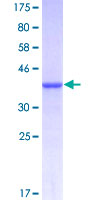 ab161292 on a 12.5% SDS-PAGE stained with Coomassie Blue.