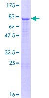 ab164925 on a 12.5% SDS-PAGE stained with Coomassie Blue.