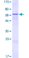 ab164996 on a 12.5% SDS-PAGE stained with Coomassie Blue.