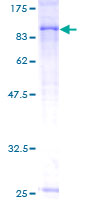 ab163460 on a 12.5% SDS-PAGE stained with Coomassie Blue.