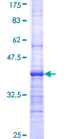 ab163461 on a 12.5% SDS-PAGE stained with Coomassie Blue.