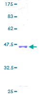 ab165897 on a 12.5% SDS-PAGE stained with Coomassie Blue.