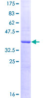 ab153413 on a 12.5% SDS-PAGE stained with Coomassie Blue.