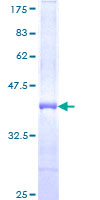ab157849 on a 12.5% SDS-PAGE stained with Coomassie Blue.
