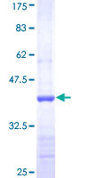 ab157850 on a 12.5% SDS-PAGE stained with Coomassie Blue.