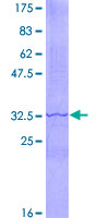 ab157851 on a 12.5% SDS-PAGE stained with Coomassie Blue.