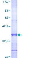 ab157852 on a 12.5% SDS-PAGE stained with Coomassie Blue.