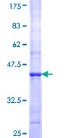 ab157853 on a 12.5% SDS-PAGE stained with Coomassie Blue.