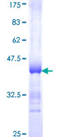 ab157857 on a 12.5% SDS-PAGE stained with Coomassie Blue.