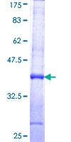 ab157859 on a 12.5% SDS-PAGE stained with Coomassie Blue.