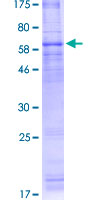 ab153327 on a 12.5% SDS-PAGE stained with Coomassie Blue.