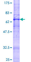 ab153509 on a 12.5% SDS-PAGE stained with Coomassie Blue.