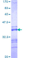 ab161620 on a 12.5% SDS-PAGE stained with Coomassie Blue.