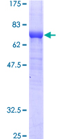 ab157864 on a 12.5% SDS-PAGE stained with Coomassie Blue.