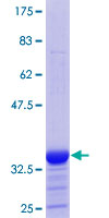 ab165185 on a 12.5% SDS-PAGE stained with Coomassie Blue.