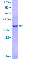 ab161106 on a 12.5% SDS-PAGE stained with Coomassie Blue.
