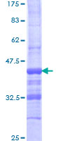 ab157867 on a 12.5% SDS-PAGE stained with Coomassie Blue.
