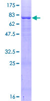 ab166192 on a 12.5% SDS-PAGE stained with Coomassie Blue.