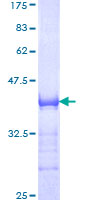 ab159930 on a 12.5% SDS-PAGE stained with Coomassie Blue.