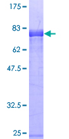 ab163707 on a 12.5% SDS-PAGE stained with Coomassie Blue.