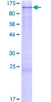 ab163708 on a 12.5% SDS-PAGE stained with Coomassie Blue.