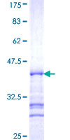 ab163709 on a 12.5% SDS-PAGE stained with Coomassie Blue.