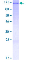ab164623 on a 12.5% SDS-PAGE stained with Coomassie Blue.