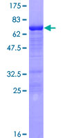 ab162086 on a 12.5% SDS-PAGE stained with Coomassie Blue.
