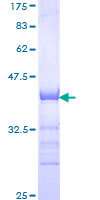 ab162087 on a 12.5% SDS-PAGE stained with Coomassie Blue.