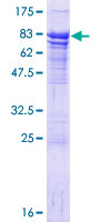 ab158696 on a 12.5% SDS-PAGE stained with Coomassie Blue.