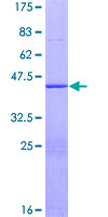 ab158697 on a 12.5% SDS-PAGE stained with Coomassie Blue.