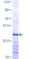 ab158698 on a 12.5% SDS-PAGE stained with Coomassie Blue.