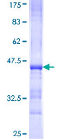 ab157869 on a 12.5% SDS-PAGE stained with Coomassie Blue.