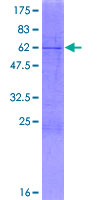 ab164123 on a 12.5% SDS-PAGE stained with Coomassie Blue.