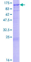 ab162000 on a 12.5% SDS-PAGE stained with Coomassie Blue.