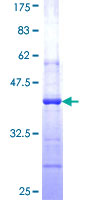 ab162001 on a 12.5% SDS-PAGE stained with Coomassie Blue.