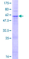 ab161041 on a 12.5% SDS-PAGE stained with Coomassie Blue.