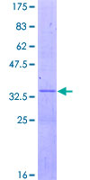 ab163412 on a 12.5% SDS-PAGE stained with Coomassie Blue.
