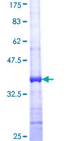 ab163413 on a 12.5% SDS-PAGE stained with Coomassie Blue.