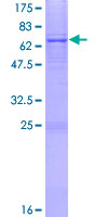 ab163064 on a 12.5% SDS-PAGE stained with Coomassie Blue.