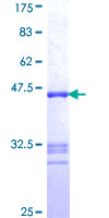 ab161588 on a 12.5% SDS-PAGE stained with Coomassie Blue.