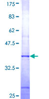 ab163900 on a 12.5% SDS-PAGE stained with Coomassie Blue.