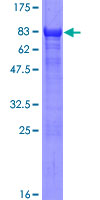ab153123 on a 12.5% SDS-PAGE stained with Coomassie Blue.