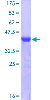 ab153124 on a 12.5% SDS-PAGE stained with Coomassie Blue.