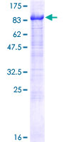 ab164994 on a 12.5% SDS-PAGE stained with Coomassie Blue.