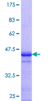 ab164995 on a 12.5% SDS-PAGE stained with Coomassie Blue.