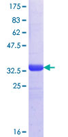 ab165578 on a 12.5% SDS-PAGE stained with Coomassie Blue.