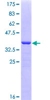 ab160351 on a 12.5% SDS-PAGE stained with Coomassie Blue.
