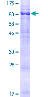 ab165603 on a 12.5% SDS-PAGE stained with Coomassie Blue.