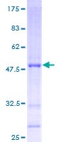 ab162540 on a 12.5% SDS-PAGE stained with Coomassie Blue.